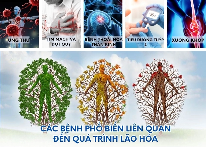 Cùng nhận biết các bệnh phổ biến liên quan đến quá trình lão hóa