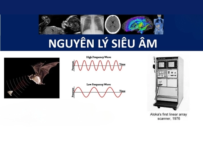 Tìm hiểu Nguyên lý hoạt động của siêu âm