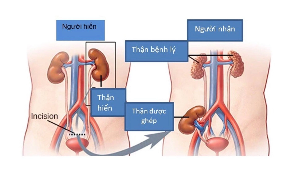 Khám phá bước ngoặt trong lĩnh vực ghép tạng kỳ diệu