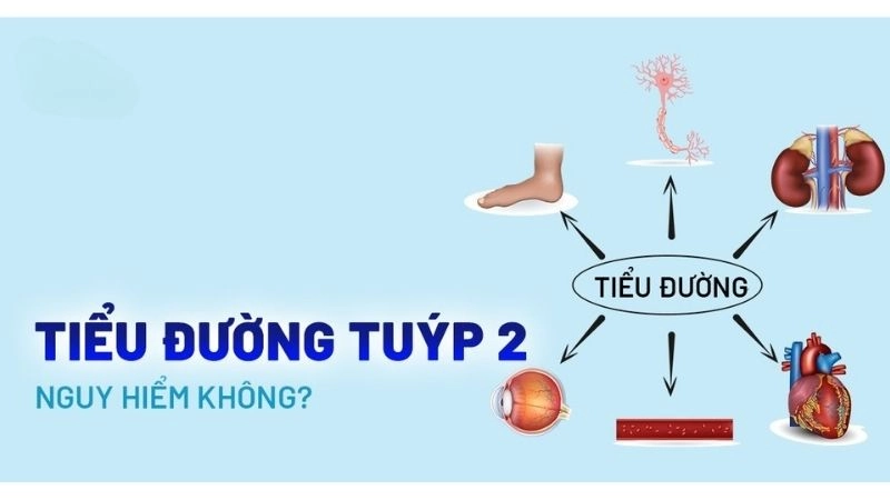 Dấu hiệu nhận biết bệnh đái tháo đường loại 2
