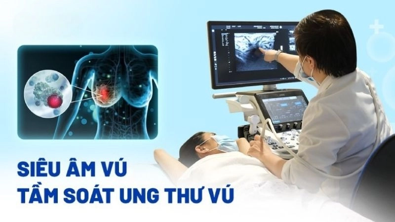 Siêu âm vú là xét nghiệm hình ảnh sử dụng đầu dò có sóng âm tần số cao di chuyển trên vú và các mô xung quanh để chụp cấu trúc bên trong