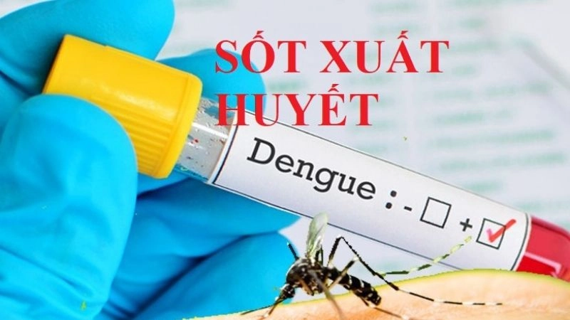 Sốt xuất huyết là một bệnh nhiễm trùng cấp tính do virus Dengue gây ra