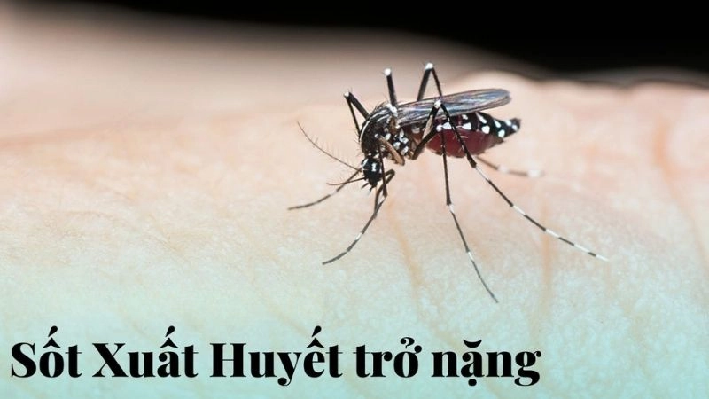 Sốt xuất huyết nặng có thể gây sốc và chảy máu trong