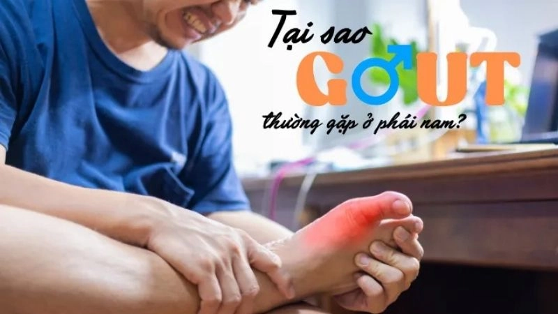 tỷ lệ mắc bệnh gout ở nam giới cao hơn đáng kể so với phụ nữ.