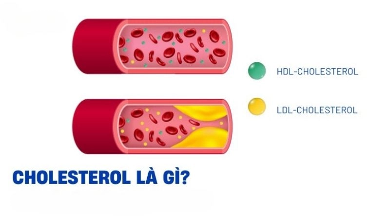 Cholesterol là một loại lipid thực hiện nhiều công việc thiết yếu trong cơ thể