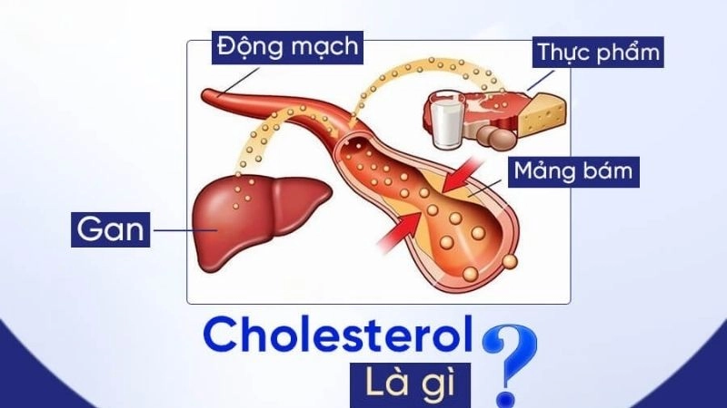 Cholesterol máu đóng một vai trò rất quan trọng đối với sức khỏe con người