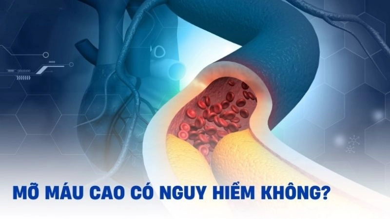 Mỡ máu cao là là một tình trạng nguy hiểm đối với sức khỏe