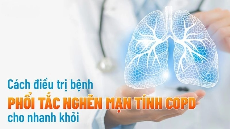 Điều trị bệnh phổi tắc nghẽn mãn tính (COPD)