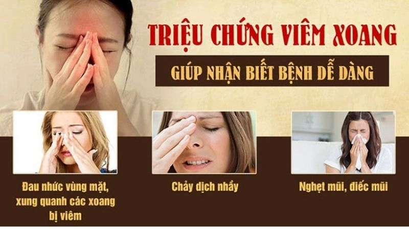  các triệu chứng viêm xoang điển hình mà người bệnh dễ gặp phải 