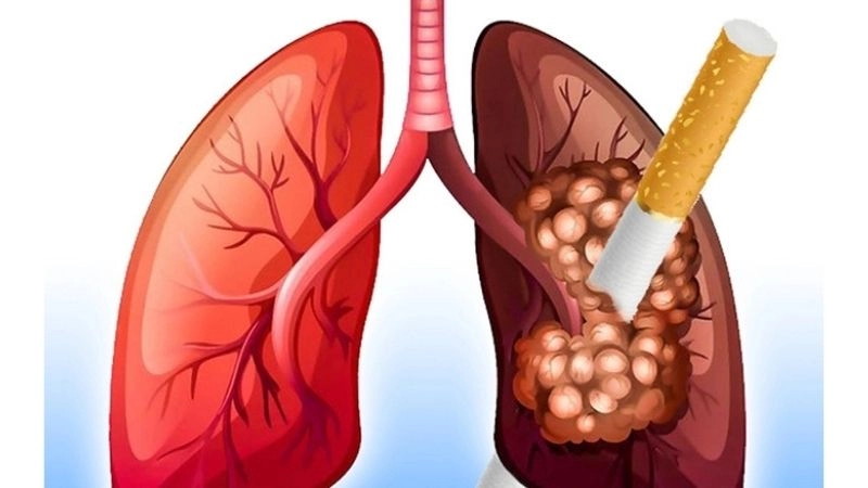 Tránh hút thuốc lá và khói thuốc để phổi khỏe mạnh