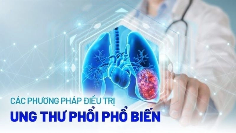 Cách chữa trị bệnh ung thư phổi
