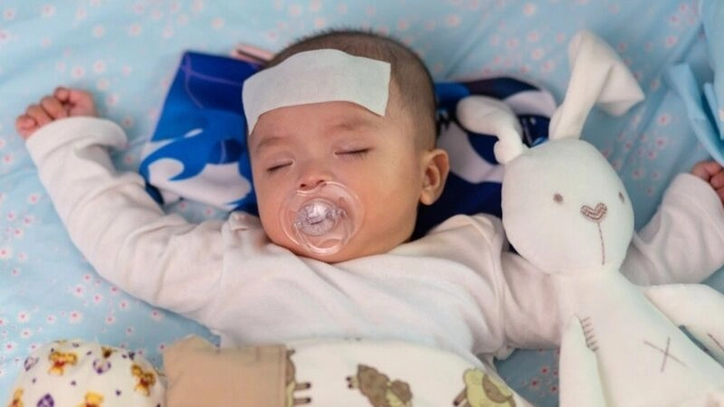 Virus RSV đi vào hệ hô hấp trên của trẻ