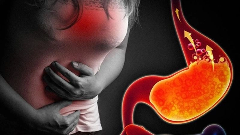 Bệnh trào ngược dạ dày thực quản có thể gặp ở bất kỳ ai