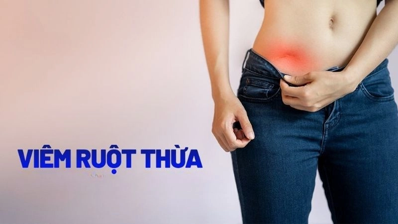 Viêm ruột thừa là tình trạng ruột thừa bị viêm do một số nguyên nhân điển hình