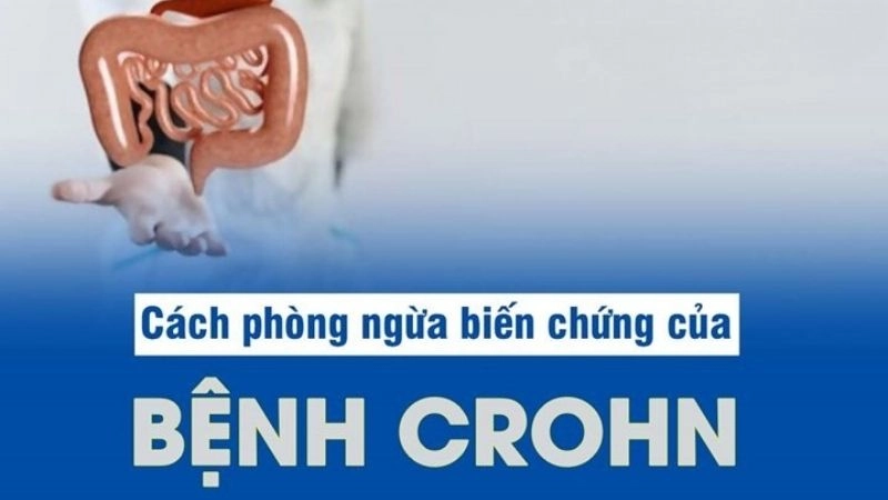 Điều trị bệnh Crohn đòi hỏi sự kiên trì
