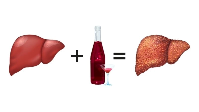 Tiêu thụ rượu bia quá mức có thể ảnh hưởng nghiêm trọng đến chức năng gan