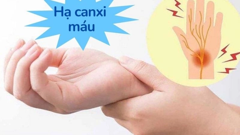 phòng ngừa co giật do hạ canxi máu