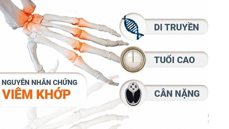 y khoa vẫn chưa tìm được lý do vì sao hay nguyên nhân chính xác gây ra tình trạng viêm khớp dạng thấp