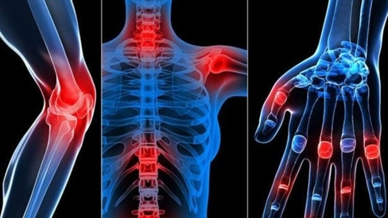 Các biểu hiện trong thoái hóa khớp thường phát triển chậm