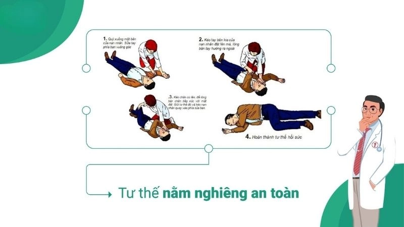 Hướng dẫn sơ cứu cho người bị tai biến mạch máu não