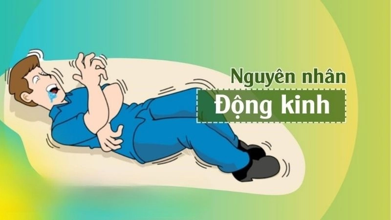 Động kinh là căn bệnh phổ biến do nhiều nguyên nhân hay yếu tố nguy cơ gây ra