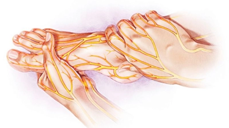 dấu hiệu và triệu chứng của bệnh thần kinh ngoại biên