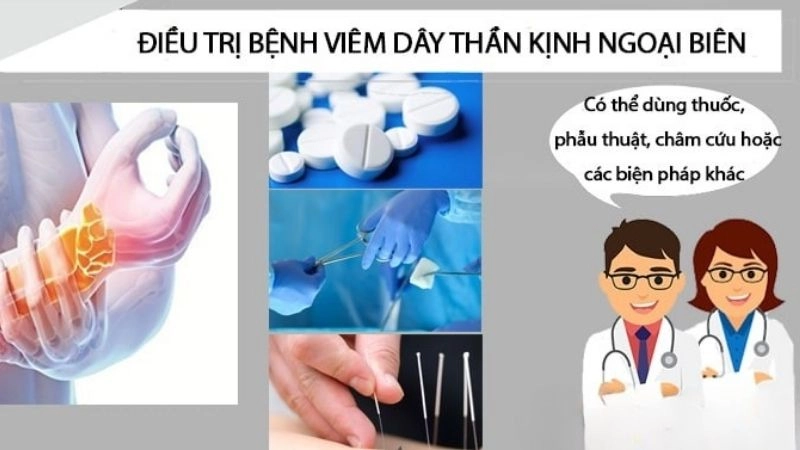 Phương pháp điều trị bệnh thần kinh ngoại biên hiệu quả