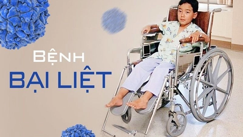 Bệnh bại liệt là một bệnh truyền nhiễm
