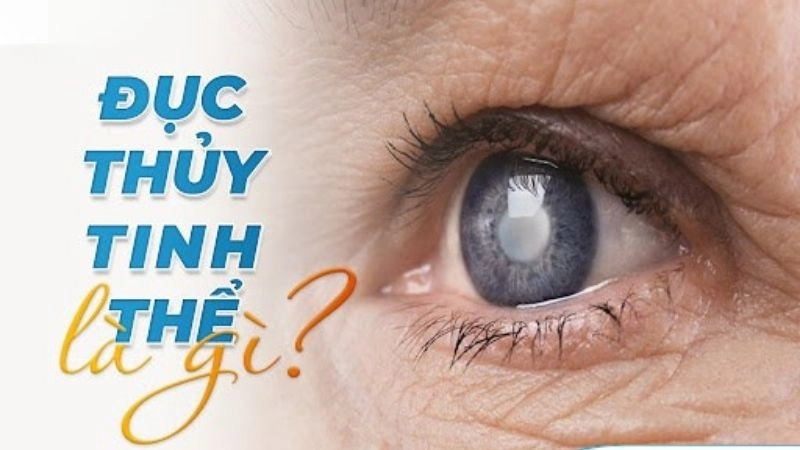 Thủy tinh thể giống như 1 thấu kính tự nhiên của mắt