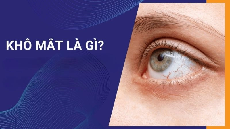 Khô mắt là tình trạng màng phim nước mắt bị rối loạn